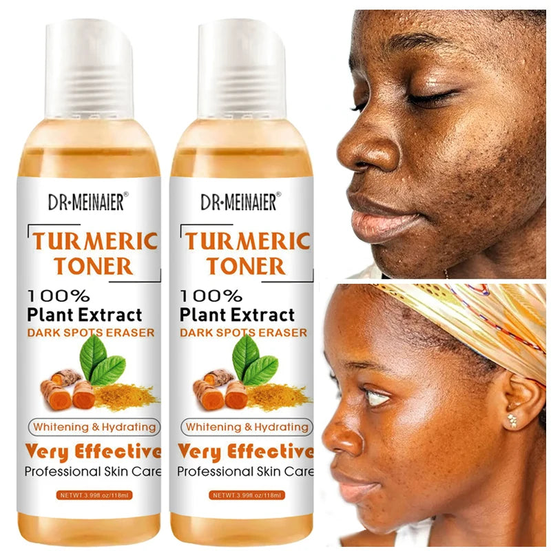 1/2/3pcs Turmeric Toner Face Brightening Dark Corrector Moisturizing Face Serum Vitamin C Ginger Essence Skin Lightener 118ml/pc