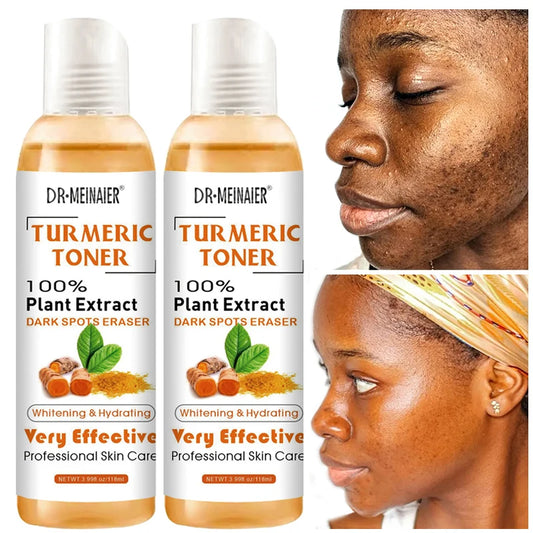 1/2/3pcs Turmeric Toner Face Brightening Dark Corrector Moisturizing Face Serum Vitamin C Ginger Essence Skin Lightener 118ml/pc
