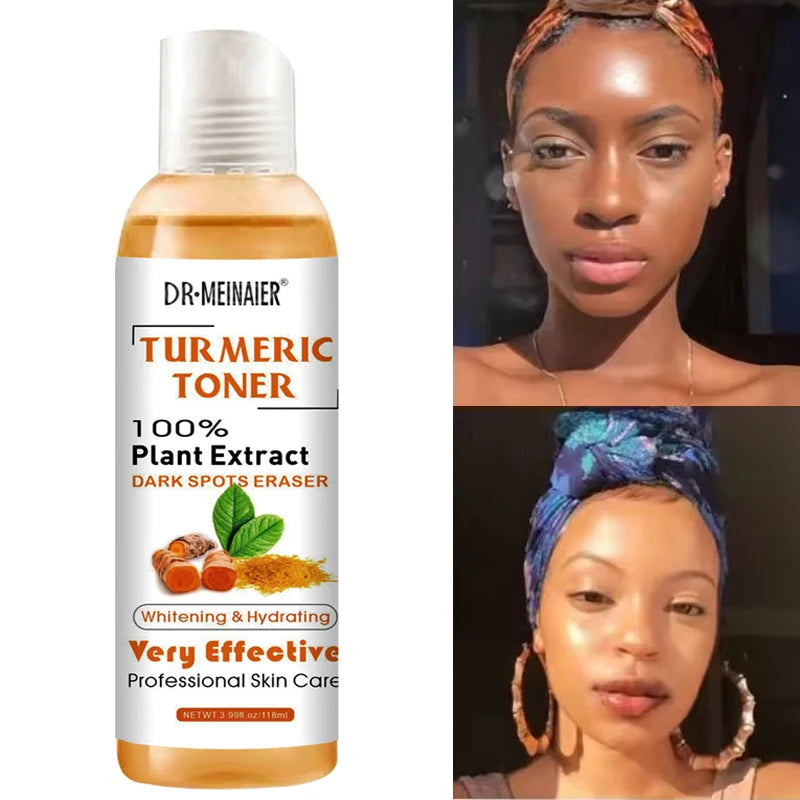 1/2/3pcs Turmeric Toner Face Brightening Dark Corrector Moisturizing Face Serum Vitamin C Ginger Essence Skin Lightener 118ml/pc
